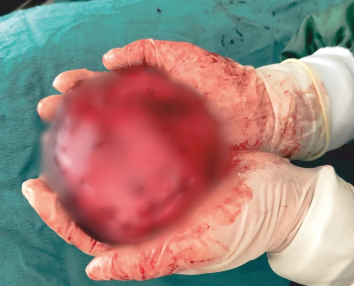 Mardin Hayvan Bakımevi&rsquo;nde Başarılı Operasyon, 1 Kiloluk T&uuml;m&ouml;r Alındı