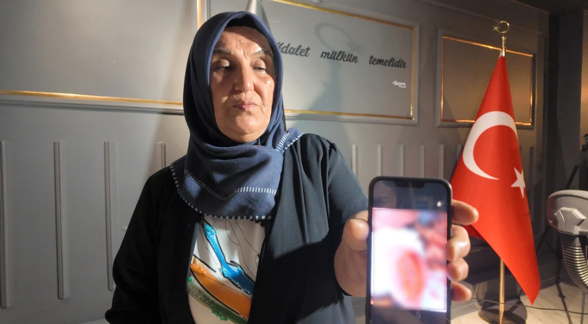 Mardin'de otomobilin &ccedil;arptığı ve sonrasında darbedilen kadının adalet &ccedil;ağrısı