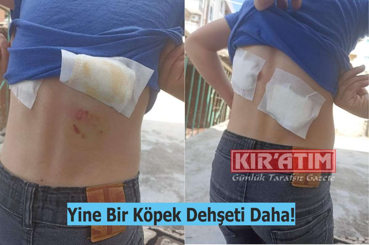 Yine Bir Köpek Dehşeti Daha!